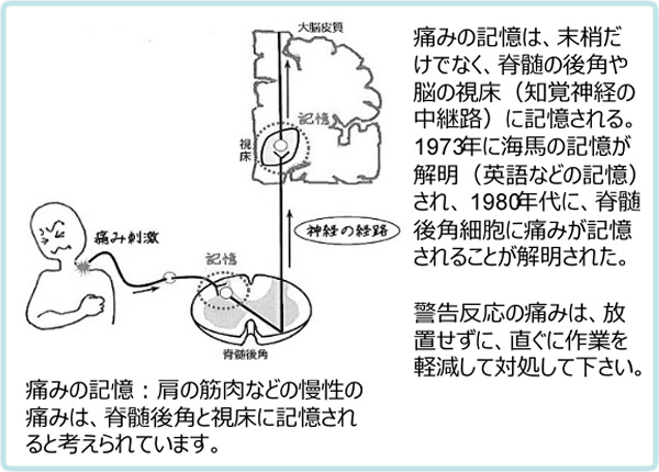 痛みの記憶