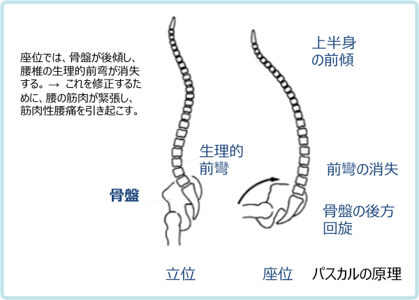 坐位による腰椎の生理的前弯の消失